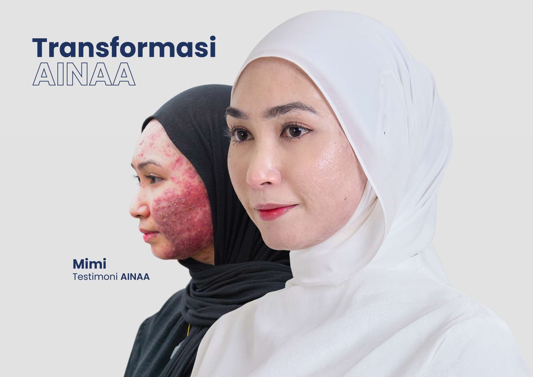 Transformasi Mimi